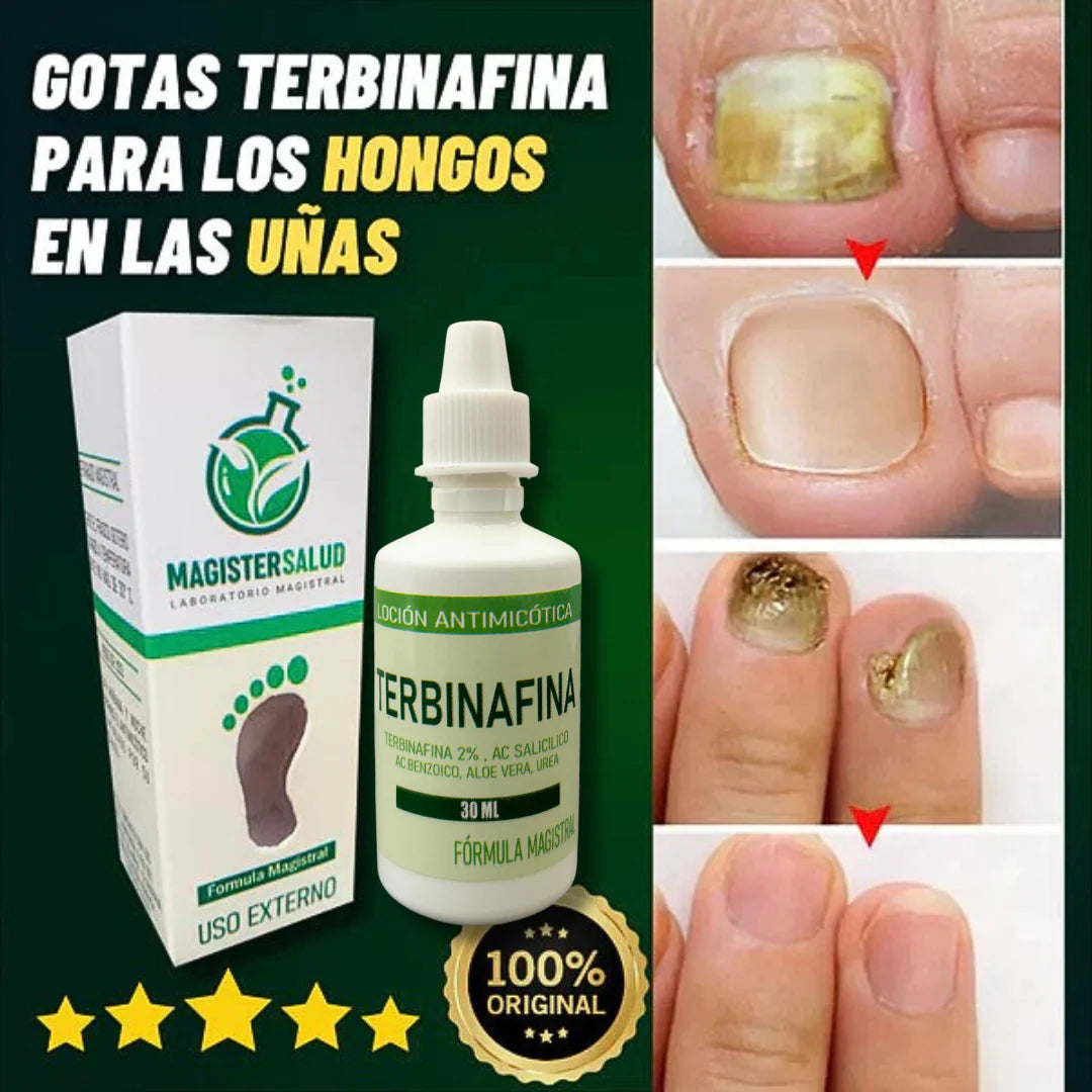 TERBINAFINA - ELIMINA LOS HONGOS DE LAS UÑAS 2x 99 SOLES