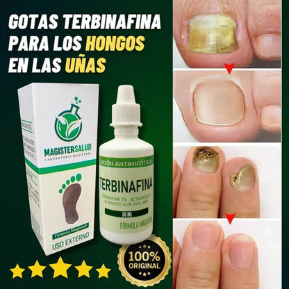 TERBINAFINA - ELIMINA LOS HONGOS DE LAS UÑAS 2x 99 SOLES