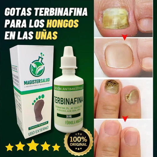 TERBINAFINA - ELIMINA LOS HONGOS DE LAS UÑAS 2x 99 SOLES